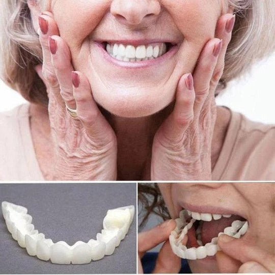 Over Smile Fineer Set voor Perfecte Glimlach 1