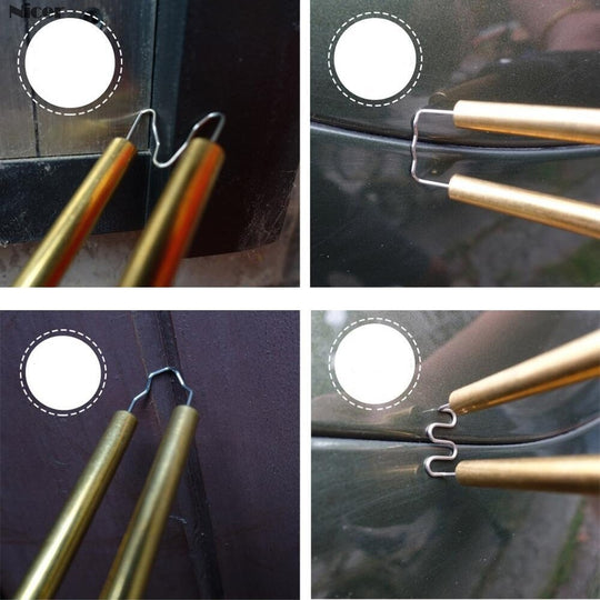 Ultieme Lasapparaat Belleza